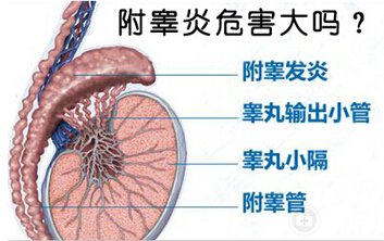 附睾炎的危害有多大