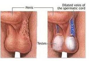 睾炎丸对男性的精子有什么损害！
